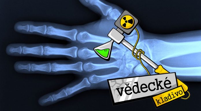 Ako funguje röntgen?